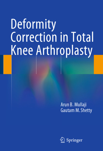 اصلاح ضریب اصلاح در آرتروپلاستی کامل زانو