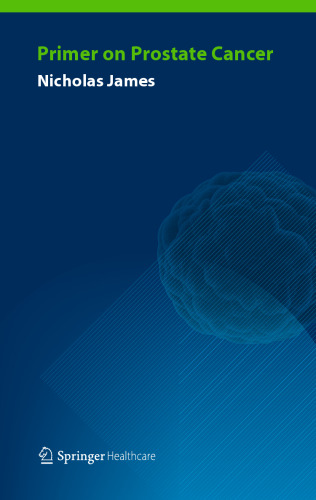 ﻿پرایمر سرطان پروستات