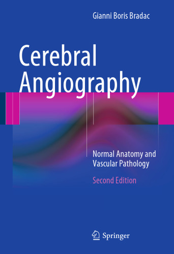 ﻿آنژیوگرافی مغزی: آناتومی طبیعی و آسیب شناسی عروقی