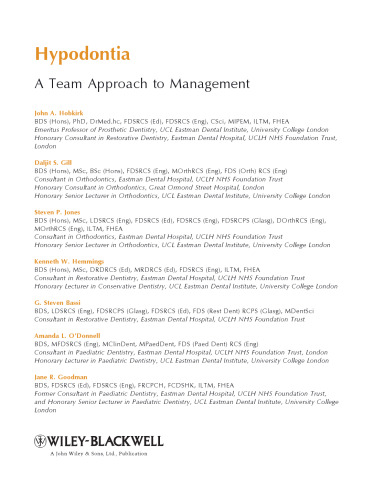 هیپودونتیا