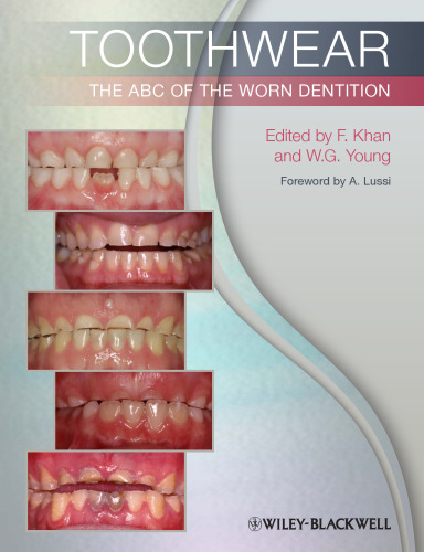 ﻿لباس دندان: ABC of the Worn Dentition