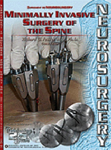 جراحی کم تهاجمی ستون فقرات