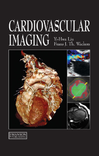 ﻿تصویربرداری قلب و عروق