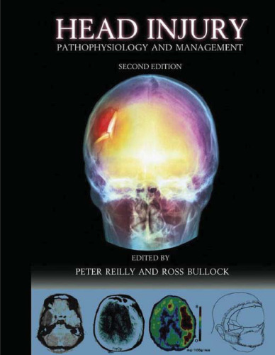 ﻿Head Injury 2Ed: Pathophysiology