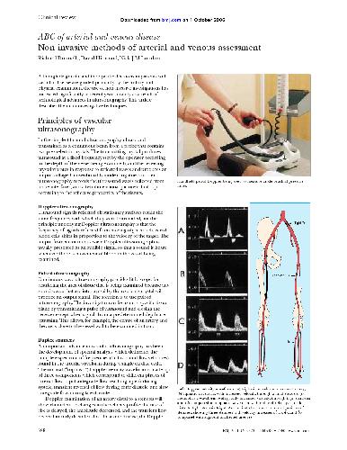 ﻿ABC بیماری شریانی و وریدی