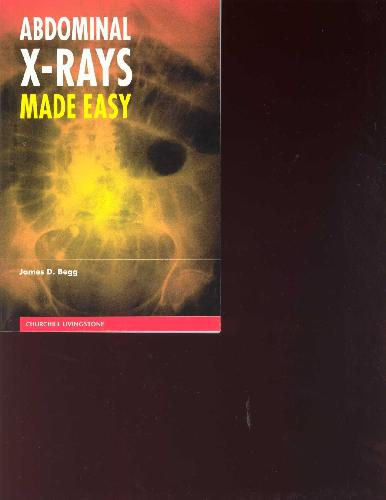 ﻿اشعه ایکس شکم آسان شد