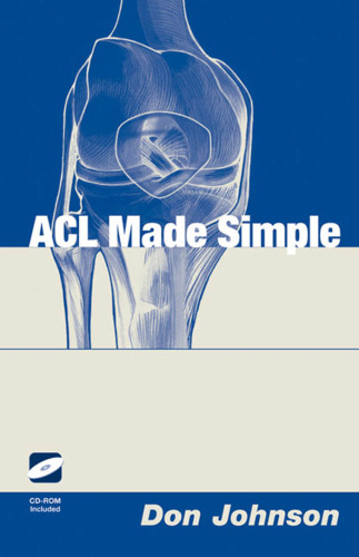 ﻿ACL ساده ساخته شده است
