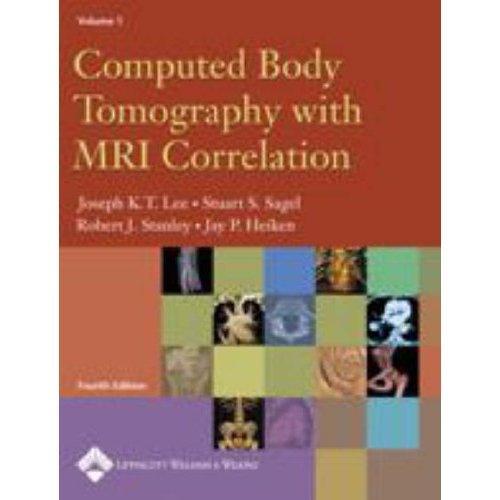 ﻿توموگرافی کامپیوتری بدن با همبستگی MRI