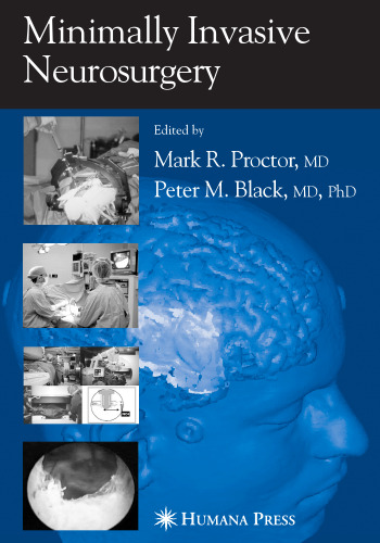 ﻿جراحی مغز و اعصاب کم تهاجمی