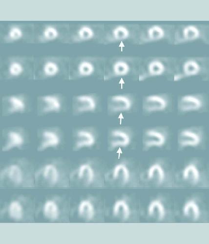 ﻿داروهای هسته ای