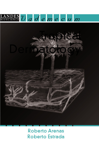 ﻿پوست گرمسیری.