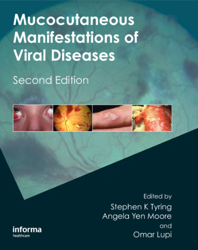 تظاهرات مخاطی بیماریهای ویروسی