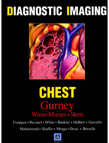 ﻿تصویربرداری تشخیصی: قفسه سینه