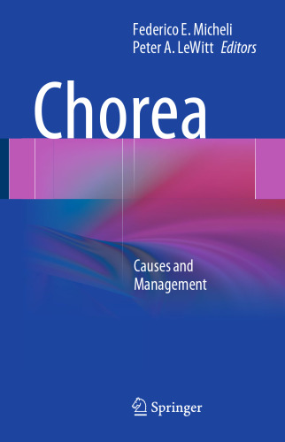 ﻿chorea: علل و مدیریت