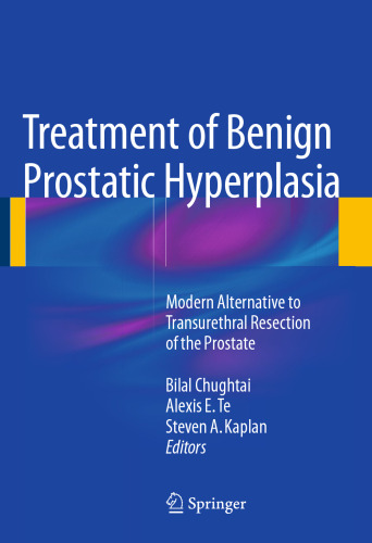 ﻿درمان هیپرپلازی خوش خیم پروستات: جایگزینی مدرن برای برداشتن مجاری ادرار از پروستات