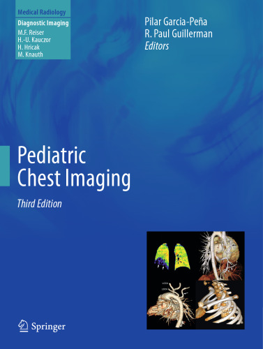 ﻿تصویربرداری قفسه سینه کودکان