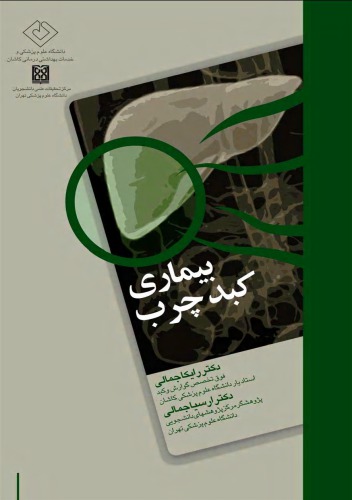 ﻿بیماری کبد چرب