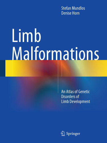 ﻿ناهنجاری های اندام: اطلسی از اختلالات ژنتیکی رشد اندام