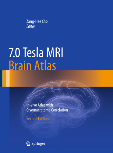 ﻿7.0 Tesla MRI Brain Atlas: In-vivo Atlas با Cryomacrotome Correlation