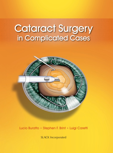 جراحی آب مروارید در موارد پیچیده