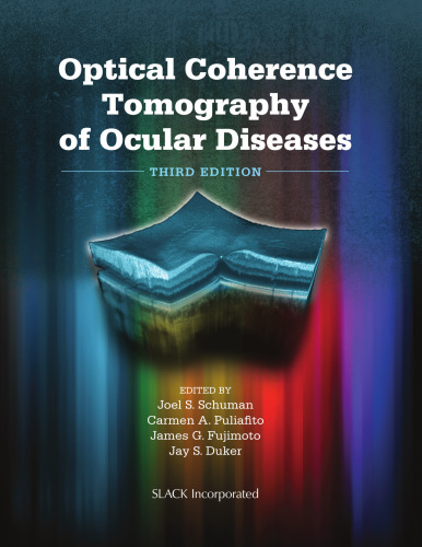 ﻿توموگرافی انسجام نوری بیماری های چشمی