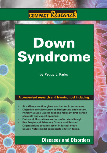 ﻿سندرم داون