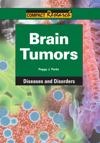 ﻿تومورهای مغزی