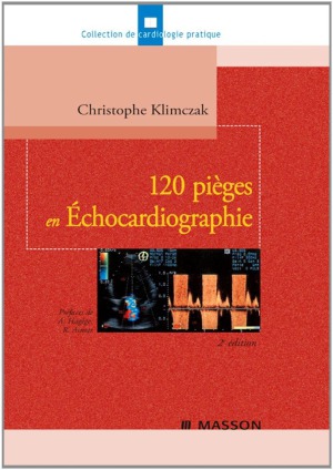 ﻿120 تله در اکوکاردیوگرافی