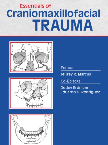 ﻿ملزومات آسیب Craniomaxillofacial