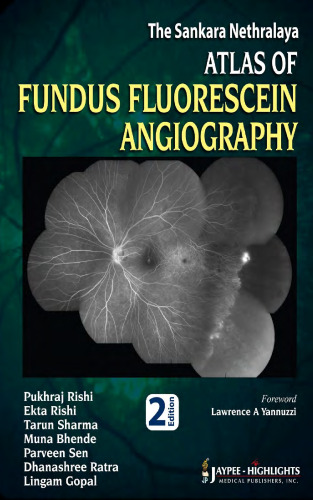 اطلس Sankara Nethralaya of Angus Fundus Fluorescein