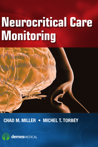 ﻿نظارت بر مراقبت های عصبی