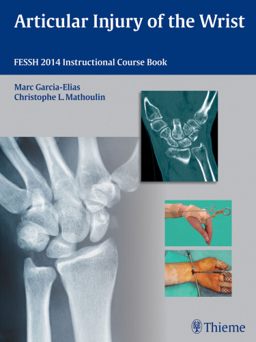 ﻿Articular Injury of the Wrist: کتاب دوره آموزشی FESSH 2014