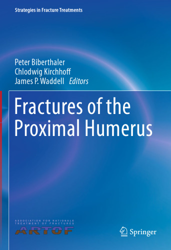 شکستگی اگزمای پروگزیمال