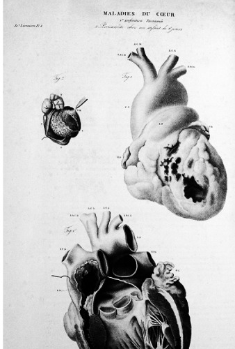 ربودن Higea. مکانیسم قدرت در زمینه سلامت و بیماری