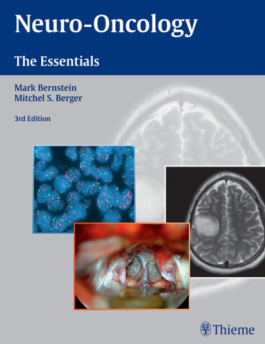 ﻿Neuro-Oncology: Essentials