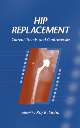 ﻿تعویض مفصل ران: روندها و بحث های فعلی