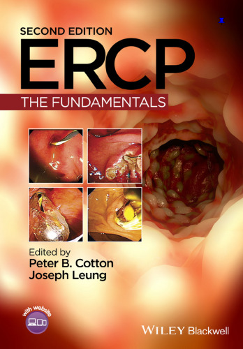 ﻿ERCP: اصول اساسی