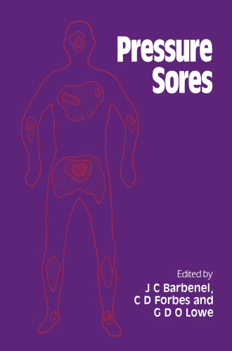 ﻿زخم های فشاری