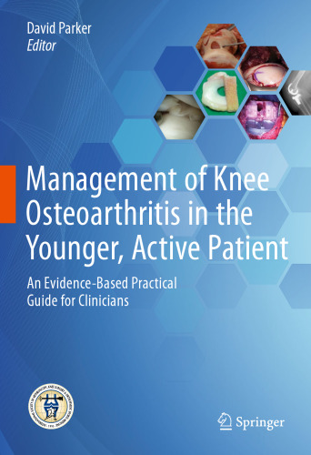 ﻿مدیریت آرتروز زانو در بیمار جوان و فعال: یک راهنمای عملی مبتنی بر شواهد برای پزشکان