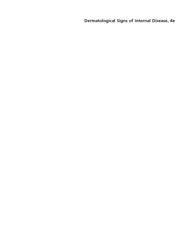 ﻿علائم پوستی بیماری های داخلی