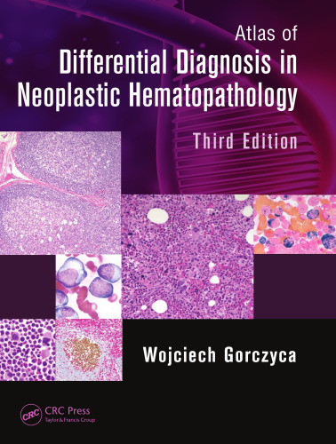 ﻿اطلس تشخیص افتراقی در هماتوپاتولوژی نئوپلاستیک