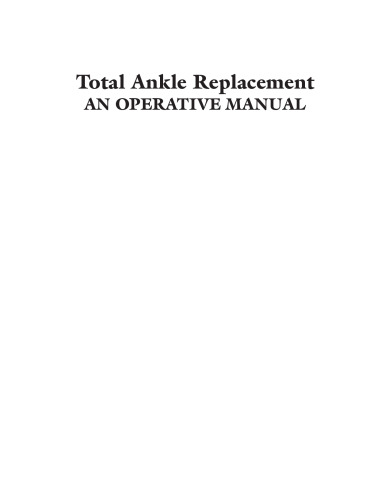 ﻿جایگزینی کامل مچ پا: کتابچه راهنمای عمل