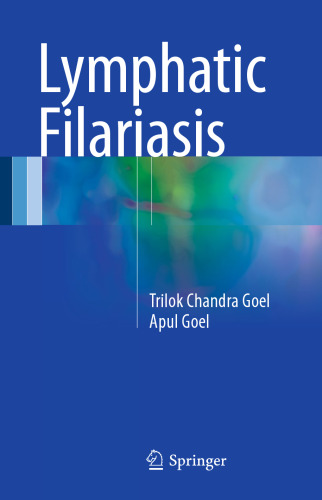 ﻿فیلاریازیس لنفاوی