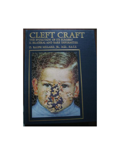 ﻿Cleft Craft. تکامل جراحی آن. دوم: ناهنجاری های دوطرفه و نادر