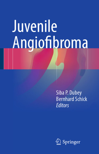 ﻿آنژیوفیبروم نوجوانان