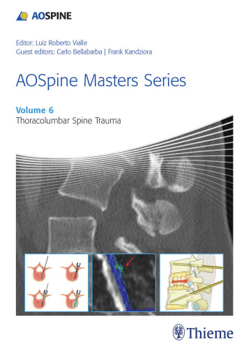 ﻿AOSpine Masters Series, Volume 6: Thoracolumbar Spine Trauma