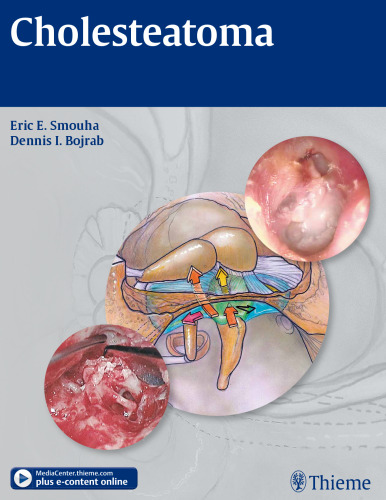 ﻿کلستئاتوم