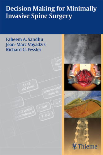 ﻿تصمیم گیری برای جراحی کم تهاجمی ستون فقرات