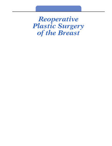 ﻿جراحی پلاستیک مجدد سینه