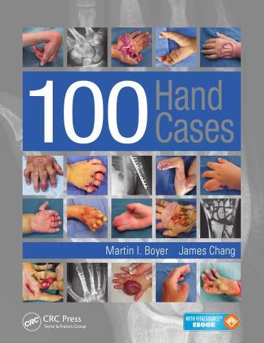 ﻿100 کیف دستی